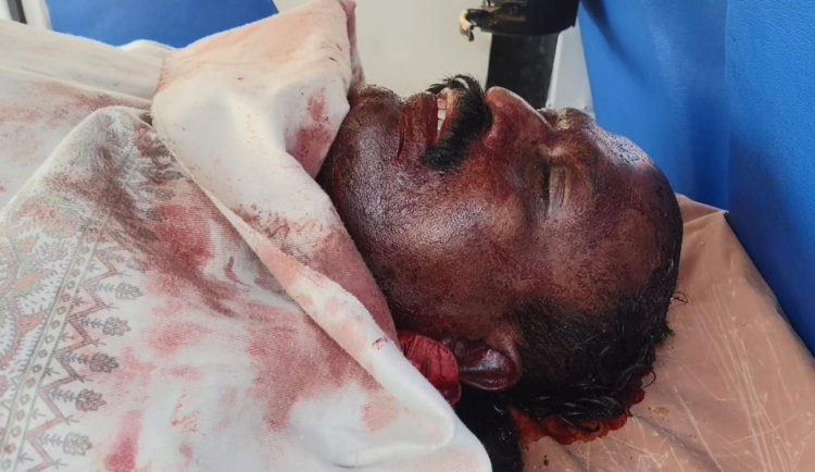 சொத்திற்காக மாமனை சராமரியாக வெட்டிக் கொன்ற மைத்துனன்.! போலீஸ் வலை வீச்சு .!