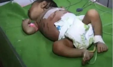 பிறந்து 1 மாதமேயான குழந்தைக்கு 40 முறை சூடு வைத்த கொடூரம்.!