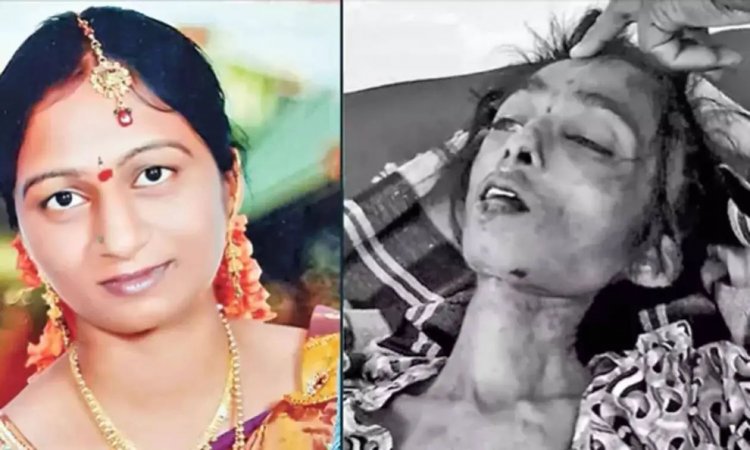 வரதட்சணை கொடுமையால் 2 ஆண்டுகளாக உணவளிக்காமல் கொன்ற கணவர். !